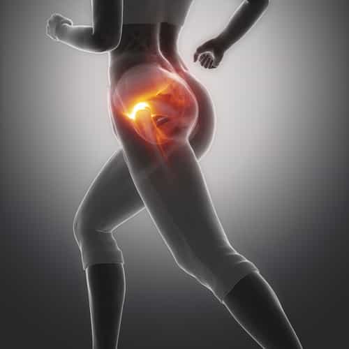 Hip Replacement Mexico vs. Canada: Costs, Quality & Patient Experience